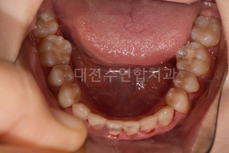 크라운 사진 2