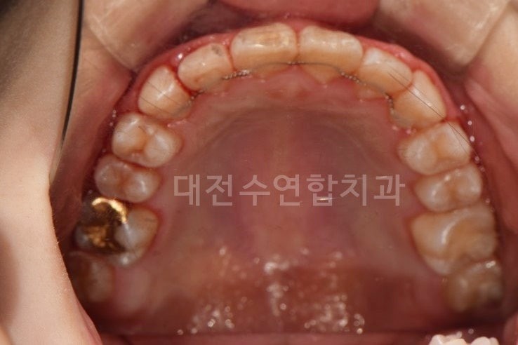 크라운 사진 1