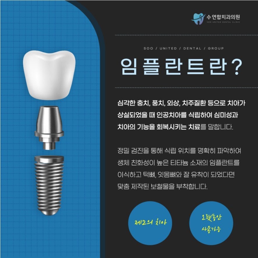 대전임플란트 식립 후 염증과 흔들림이 나타나는 원인과 확인 기준 - 수연합치과